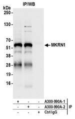 MKRN1 Antibody in Immunoprecipitation (IP)