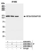 SF3b155/SAP155 Antibody in Immunoprecipitation (IP)