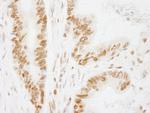 ACINUS/ACN1 Polyclonal Antibody
