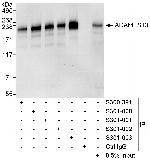 ADAMTS13 Polyclonal Antibody
