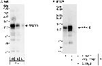 RBM10 Antibody in Western Blot (WB)