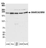 SMARCA2/BRM Polyclonal Antibody