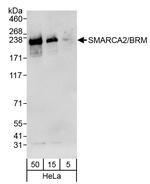 SMARCA2/BRM Polyclonal Antibody