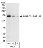 SMARCC1/BAF155 Polyclonal Antibody