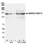 SMARCC1/BAF155 Polyclonal Antibody