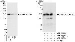 SMARCC1/BAF155 Polyclonal Antibody