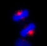 CEP170 Polyclonal Antibody