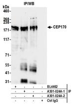 CEP170 Antibody in Immunoprecipitation (IP)