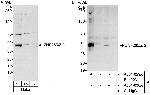 ZNF265/ZIS Antibody in Western Blot (WB)