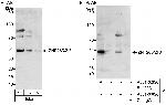 ZNF265/ZIS Antibody in Western Blot (WB)