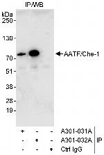 AATF/Che-1 Polyclonal Antibody