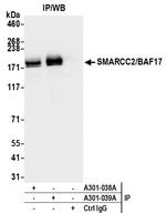 SMARCC2/BAF170 Antibody in Immunoprecipitation (IP)