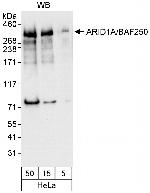 ARID1A/BAF250 Polyclonal Antibody