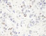 MAGED2 Polyclonal Antibody