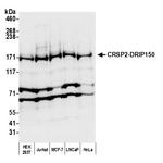 CRSP2/DRIP150 Polyclonal Antibody