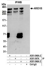 ARID1B Antibody in Immunoprecipitation (IP)