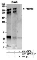 ARID1B Antibody in Immunoprecipitation (IP)