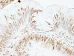 USP47 Antibody in Immunohistochemistry (Paraffin) (IHC (P))