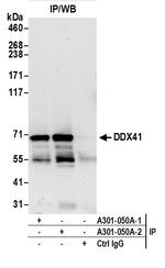 DDX41 Antibody in Immunoprecipitation (IP)