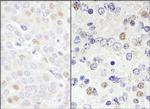 DDX46 Antibody in Immunohistochemistry (Paraffin) (IHC (P))