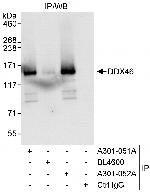 DDX46 Antibody in Immunoprecipitation (IP)