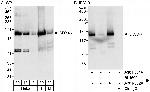 DDX46 Antibody in Western Blot (WB)