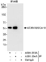 ATXN10/SCA10 Polyclonal Antibody