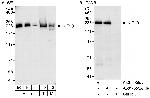 KIF1B Polyclonal Antibody