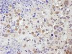 TRIM33/TIF1gamma Antibody in Immunohistochemistry (Paraffin) (IHC (P))