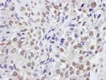 TRIM33/TIF1gamma Polyclonal Antibody