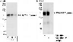 TRIM33/TIF1gamma Antibody in Western Blot (WB)