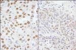 AKAP8/AKAP95 Polyclonal Antibody