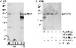 BTAF1 Polyclonal Antibody