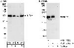 KIF4A Polyclonal Antibody