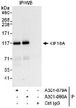 KIF18A Polyclonal Antibody