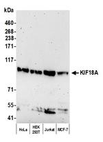 KIF18A Polyclonal Antibody