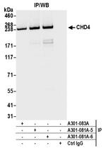 CHD4 Antibody in Immunoprecipitation (IP)