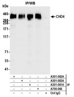 CHD4 Antibody in Immunoprecipitation (IP)