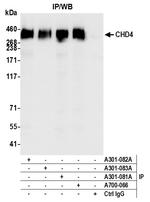 CHD4 Antibody in Immunoprecipitation (IP)