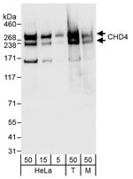 CHD4 Antibody in Western Blot (WB)