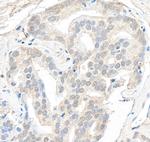 SMARCB1/SNF5 Polyclonal Antibody