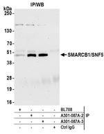 SMARCB1/SNF5 Antibody in Immunoprecipitation (IP)