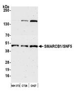 SMARCB1/SNF5 Antibody in Western Blot (WB)