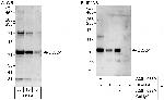 DDX51 Polyclonal Antibody