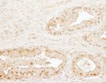 CPSF73 Polyclonal Antibody