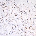 CSTF64 Polyclonal Antibody