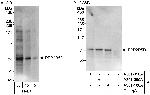 PPP2R5D Polyclonal Antibody