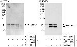 PPP2R5D Polyclonal Antibody