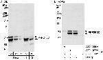 PPP2R5D Polyclonal Antibody