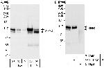XRN2 Polyclonal Antibody